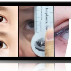 Masterclass in Asian Double Eyelid Design and Crease Formation, Third Iteration
