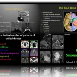 2024 Practical Head & Neck Imaging Mimics and Case-based Review