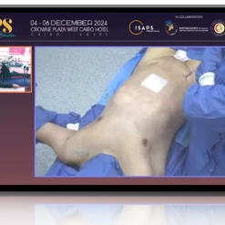 Advanced Techniques in Breast and Body Reshaping