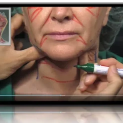 Deep Plane Face & Neck Lift With Adjunctive Rejuvenating Procedures 2025