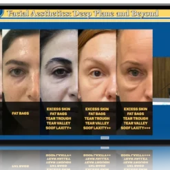 Facial Aesthetics Deep Plane and Beyond 2025