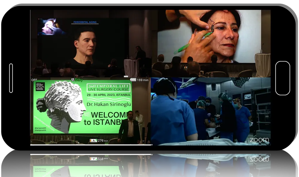 AngelsVR 2nd Temporal Lift Live Surgery Course 2023