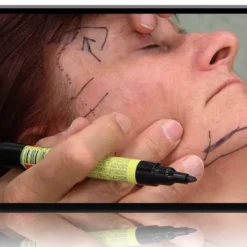 Innovative Facial Rejuvenation Techniques