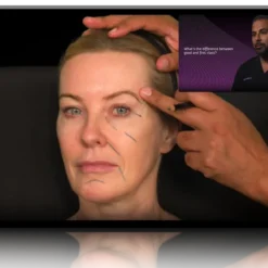 RA Summit Botox and Filler Online Course