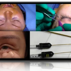 Aesthetic Eyelid and Periorbital Surgery:  Surgical Adjuncts and Pearls for Success
