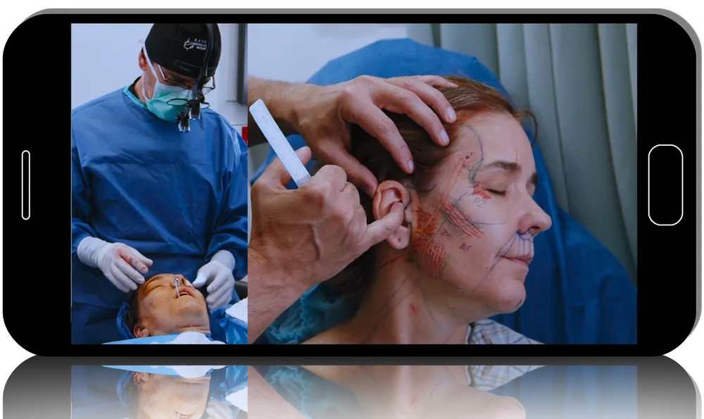 Facelift Master Course