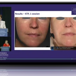 Advanced Clinical Perspectives: Navigating Cosmetic & Laser Conflicts